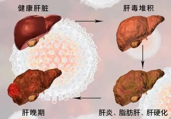 酵素代加工工厂|场景化精准营销，掘金万亿解酒市场