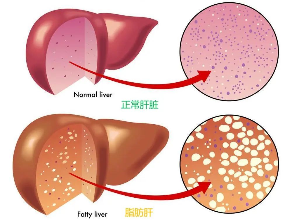 酵素加工厂|千古解酒护肝第一方！药食同源枳椇子